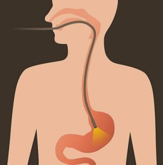 endoscopy