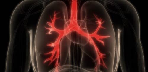 Fibrosis sistik