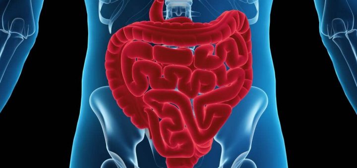 Ileus paralitik