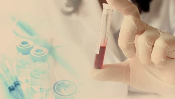 Pemeriksaan Alkali Fosfatase