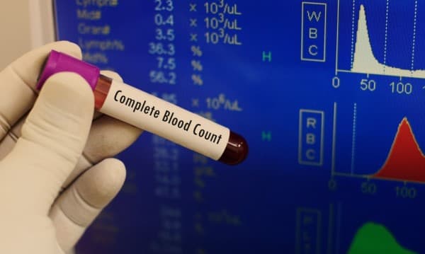 Check Complete Blood Count