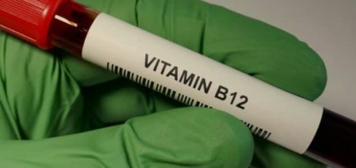Anemia Defisiensi Vitamin