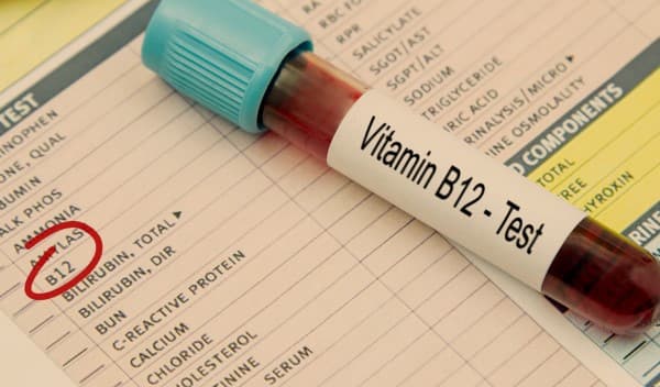Vitamin B12 and folate deficiency anemia