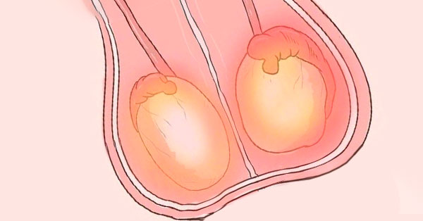 Testis