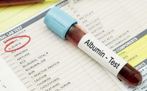 Albumin