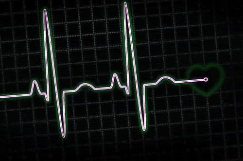 EKG