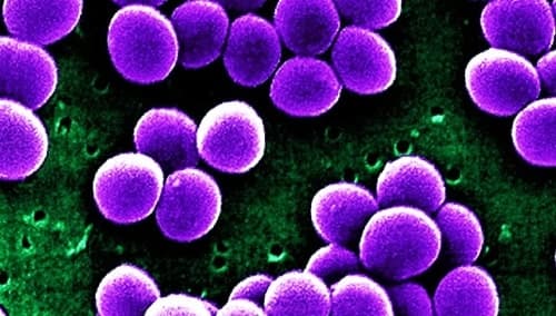 staphylococcus aureus adalah 