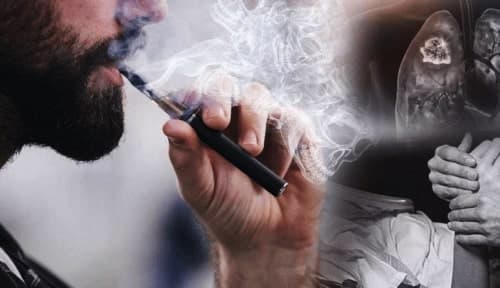 Bahaya Vaping
