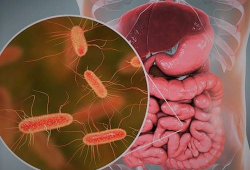 Escherichia Coli