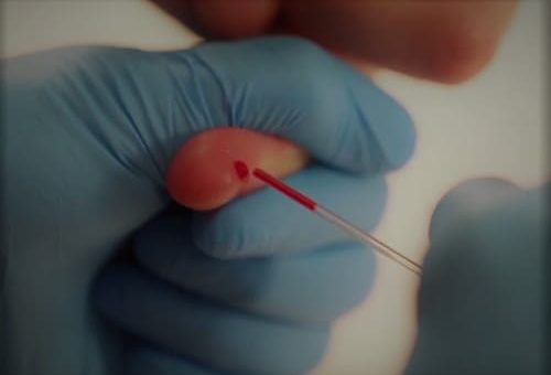 Hematokrit