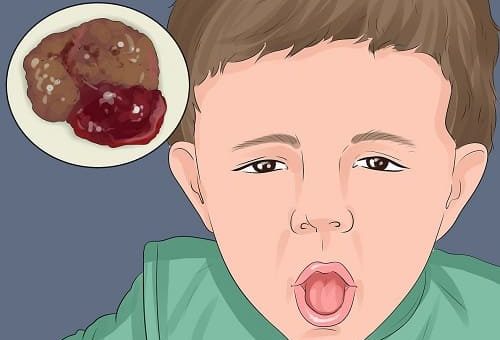 obat diare anak
