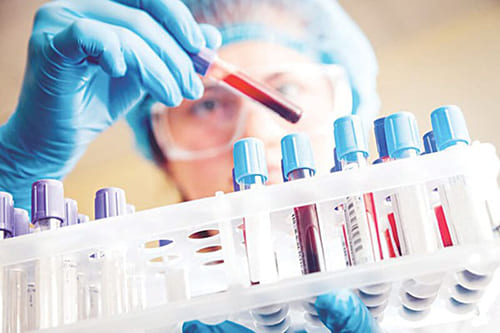 hbsag deteksi hepatitis