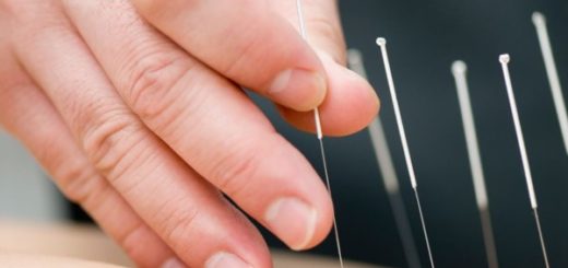 manfaat terapi akupuntur