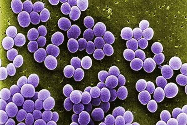 Resistensi Bakteri Terhadap Antibiotik adalah 