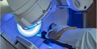 Efek Samping Radioterapi adalah