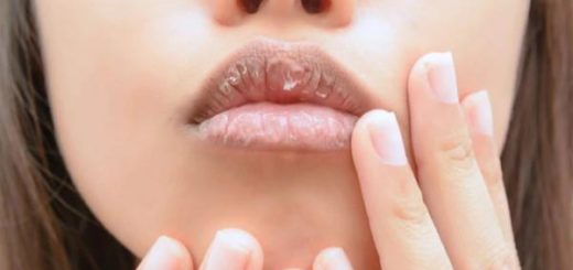 Tips Mencegah Bibir Pecah Pecah