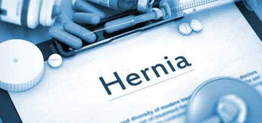 Pengobatan Hernia secara Alami