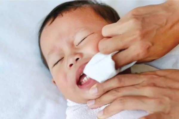 Obat Sariawan untuk Bayi 